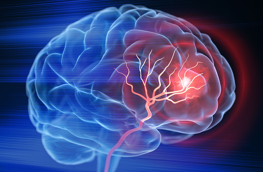 10th Annual Stroke & Endovascular Symposium for EMS and Nursing Professionals Banner